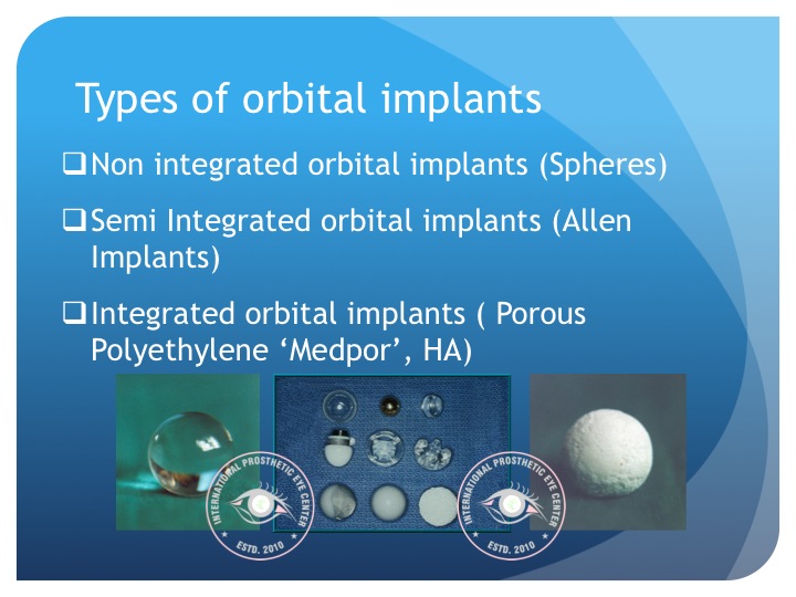  - Various Orbtial Implant-Kuldeep Raizada